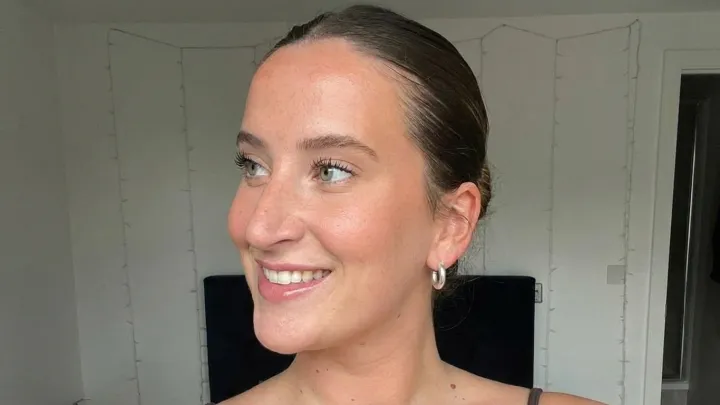 Woman sheds ‘paedophile’ fear after rare disorder