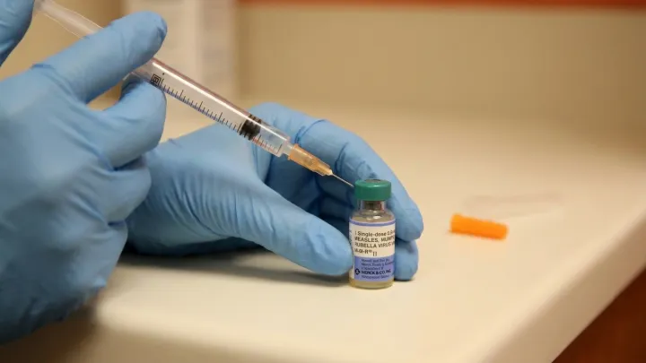 Measles Returns To San Francisco