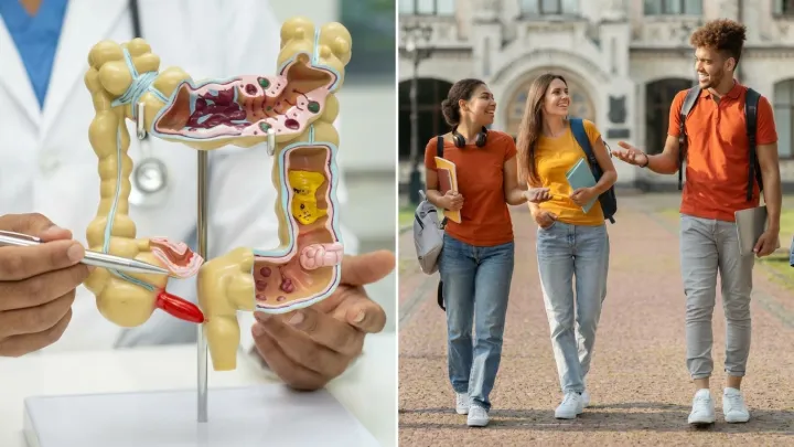 Colon cancer deaths concentrate in one group