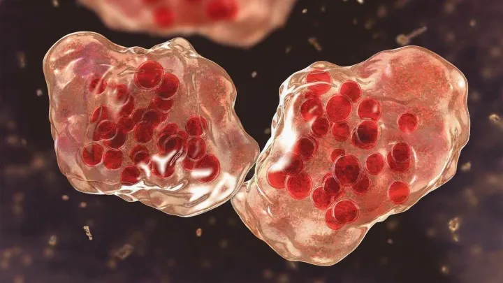 Maryland confirms imported measles case