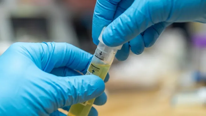 Alabama Counties With the Heaviest STD Burden