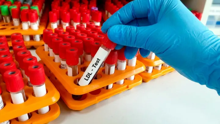 Doctors Push LDL Targets Even Lower