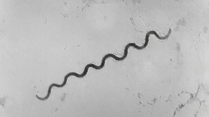 Syphilis Resurges As CDC Flags New Hotspots