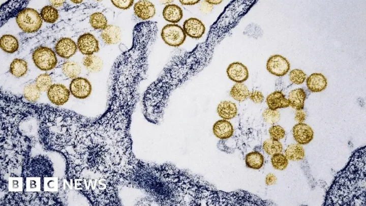 Hantavirus case confirmed after cruise deaths