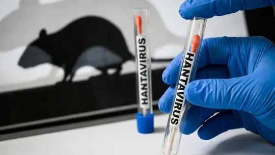 Maryland tracks two possible hantavirus cases