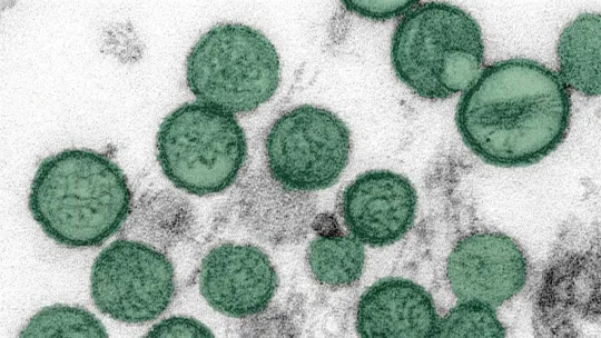 Douglas County adult dies from hantavirus