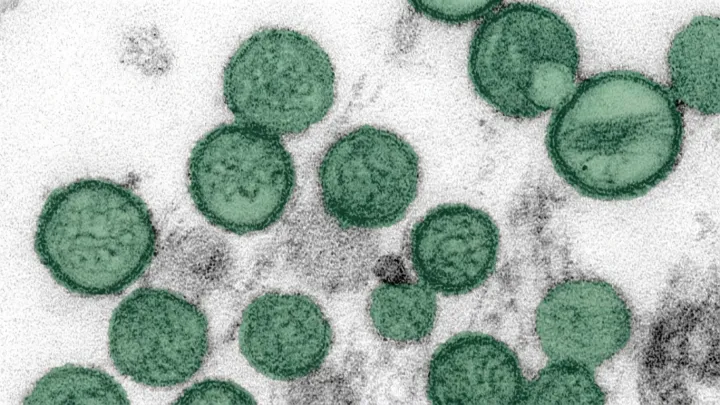 Douglas County adult dies from hantavirus