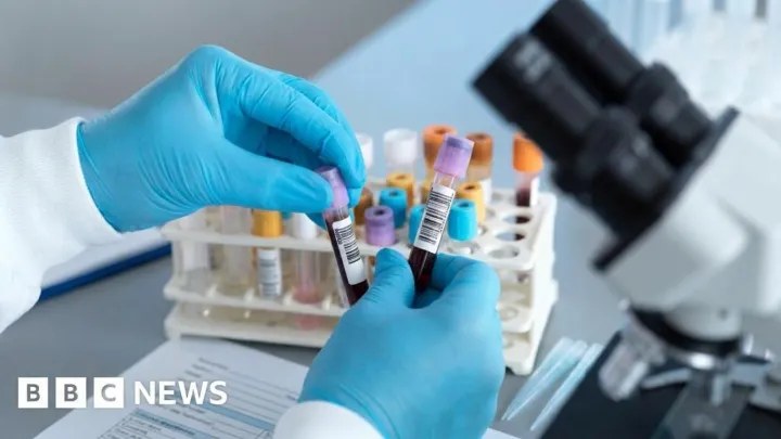 Brazil clears suspected Ebola cases