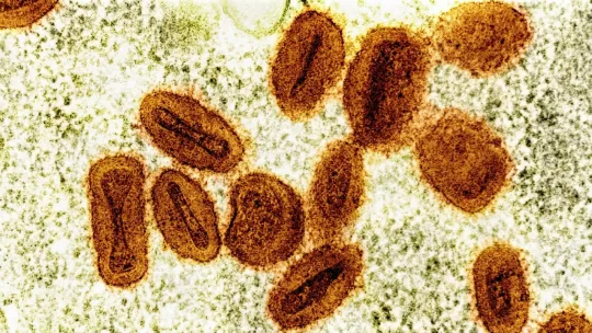 Scientists charged over undeclared mpox samples