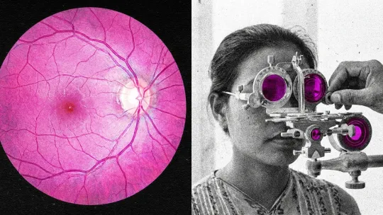 Longevity Startup Tests ER‑100 in First Human