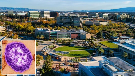 Measles exposure linked to Bay Area travel