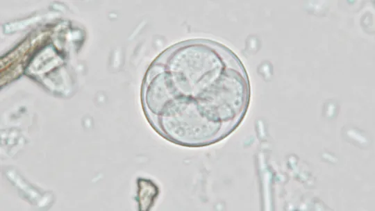 Intestinal Parasite Tied to Surge in Severe Diarrhea Across US