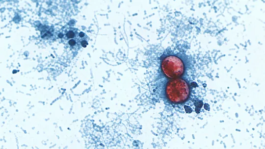 Parasite threat lurking in holiday produce