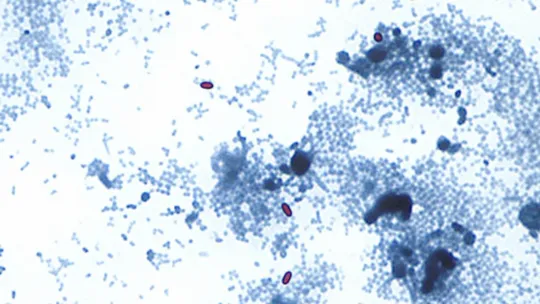 Michigan Cyclosporiasis Cases Surge to Nearly 600