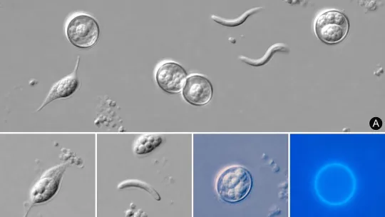 Cyclosporiasis cases rise in Ionia County