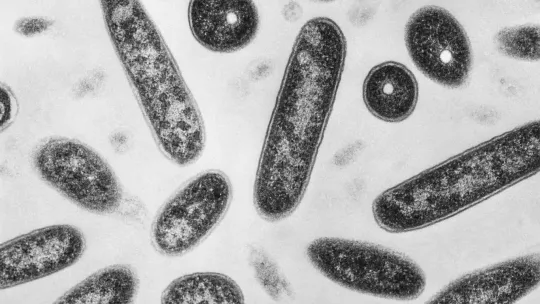 Legionnaires’ cluster hits NYC’s Upper East Side