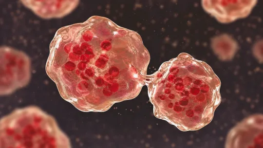 Second measles case confirmed in Tennessee