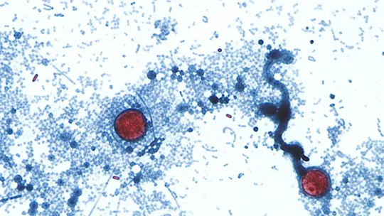 Michigan probes lettuce in cyclospora surge