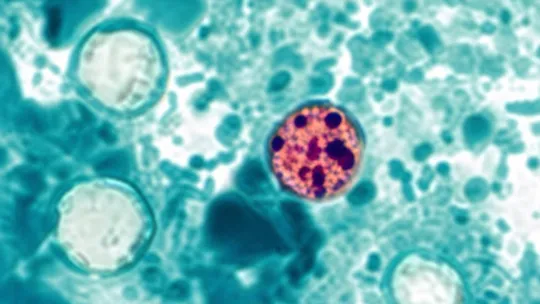 Cyclospora infections stretch through late summer