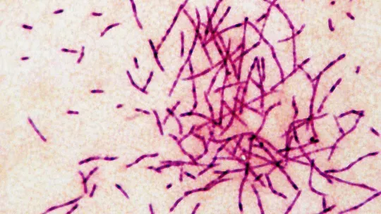 Third Death in New York Legionnaires' Cluster