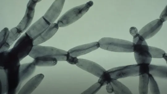 Legionnaires’ disease spike in Savoie