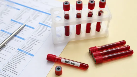 Spike in HIV cases among overseas Filipino workers