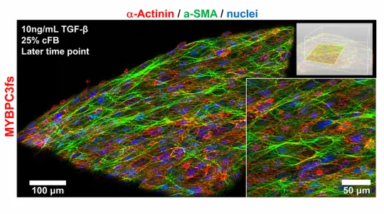Stress Exposes Cardiac Cell Crosstalk