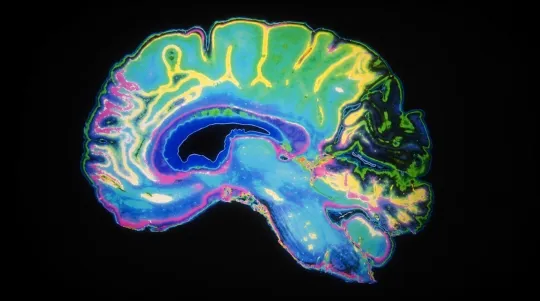MRI Maps Blood Flow Through Brain Layers