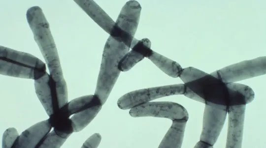 Legionnaires' Disease Alert