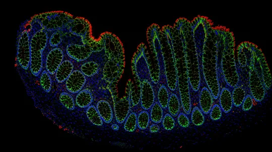 AtlasPlex Speeds Custom Five-Plex IHC