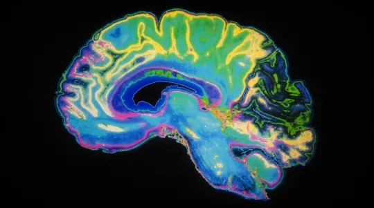 Iron Shortfalls, Lasting Brain Effects