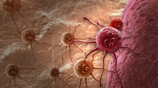 Cancer's Waste Becomes Its Weapon