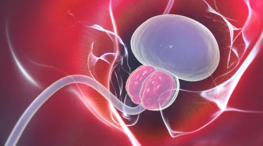Why Aging Prostates Keep Growing