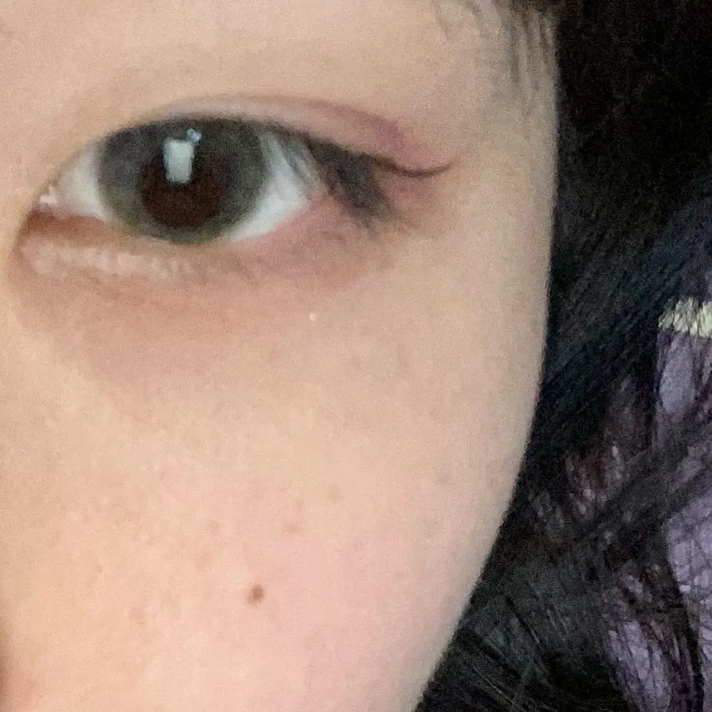 我时常在想
像我这样颧骨高的人
除了做颧骨内推是不是就没救了
….
狠狠🚬了